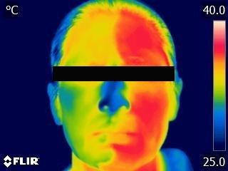 Thermal camera image of the same face after one spritz on one side: the misted side shows yellow and green (cooler), the untreated side stays red